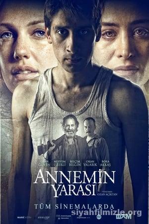 annemin yarasi